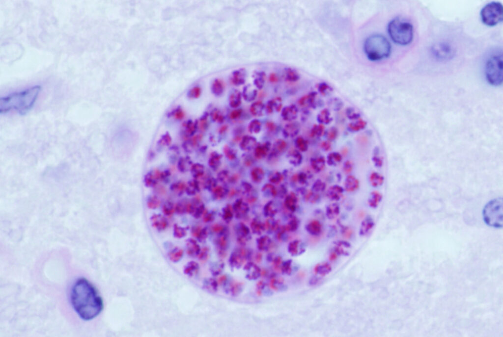 Image of Toxoplasma Gondii under electron miscoscope.